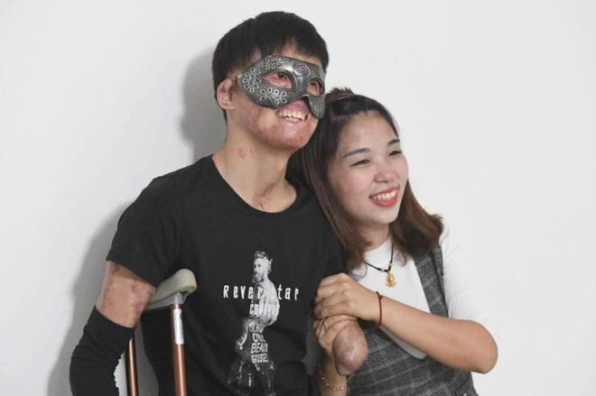 Chuyện tình của cô gái Trung Quốc và chàng trai gương mặt biến dạng-3