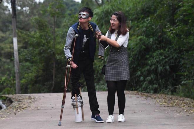 Chuyện tình của cô gái Trung Quốc và chàng trai gương mặt biến dạng-6