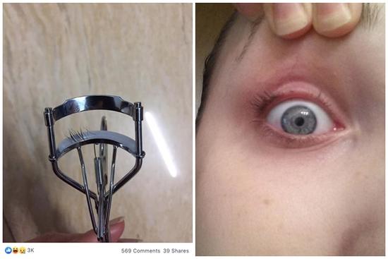 Những pha làm đẹp 'dở khóc dở cười' vì kẹp mi đi nguyên cả mảng