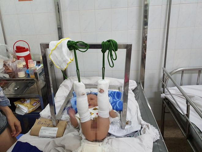 Phẫn nộ: Em bé 4 tháng tuổi ở TP HCM nghi bị bố ruột dạy dỗ đến mức gãy chân, xuất huyết não-3