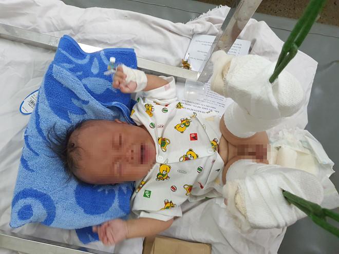 Phẫn nộ: Em bé 4 tháng tuổi ở TP HCM nghi bị bố ruột dạy dỗ đến mức gãy chân, xuất huyết não-4
