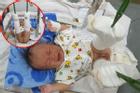 Phẫn nộ: Em bé 4 tháng tuổi ở TP HCM nghi bị bố ruột 'dạy dỗ' đến mức gãy chân, xuất huyết não