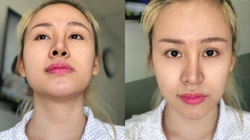 Bà Tưng khoe cận nhan sắc sau thẩm mỹ làm fans ruột hoang mang không thể nhận ra-2