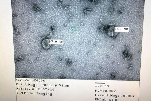 Tin vui: Việt Nam nuôi cấy và phân lập thành công virus Corona mới-1