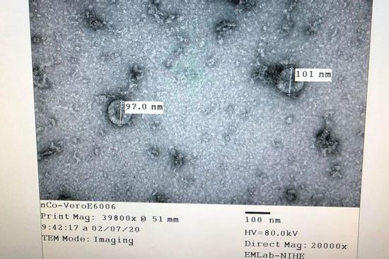 Tin vui: Việt Nam nuôi cấy và phân lập thành công virus Corona mới