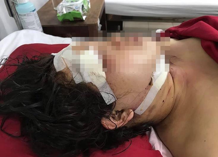 Khóa cửa, mở nhạc to đánh vợ thập tử nhất sinh rồi thắt cổ tự vẫn-1