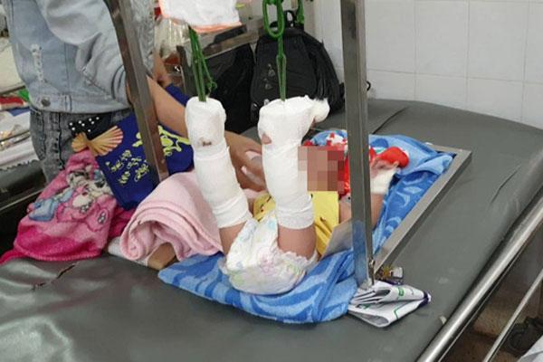 Người cha bạo hành con 4 tháng tuổi xuất huyết não, gãy xương ở Sài Gòn thừa nhận do mâu thuẫn với vợ-1