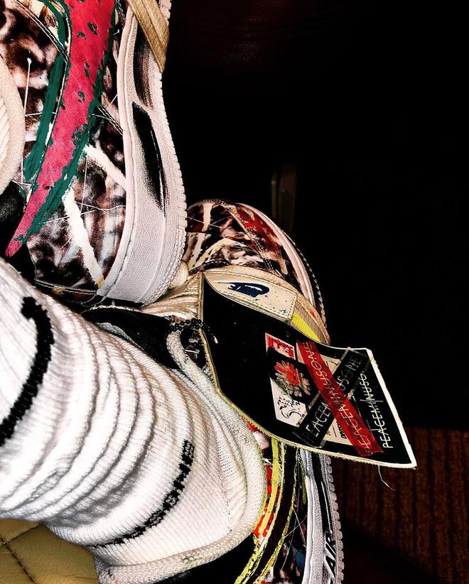 Gu thời trang thì không chê vào đâu được nhưng G-Dragon phải chăng nên xem lại làn da sần sùi của mình?-4