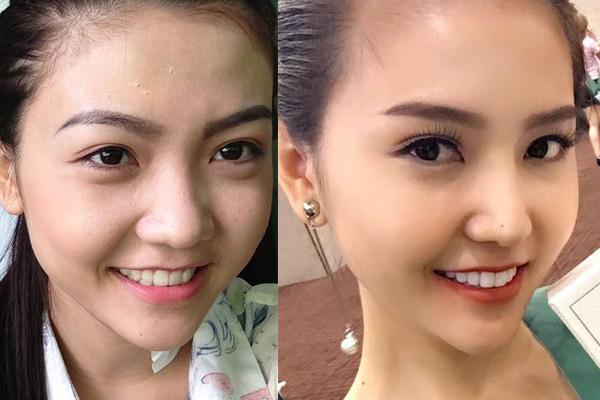 Mỹ nữ Vũng Tàu đi siêu xe 70 tỷ lộ ảnh cũ 5 năm trước, bị tố dao kéo-10