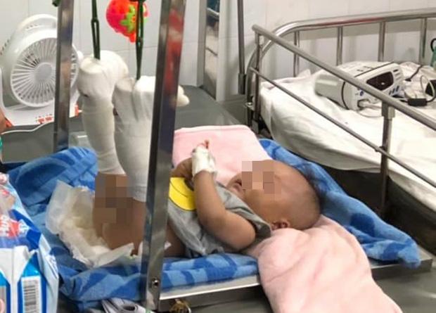 TP.HCM: Bắt tạm giam cha ruột đánh con trai 4 tháng tuổi đến xuất huyết não, gãy chân vì khóc không chịu nín-1