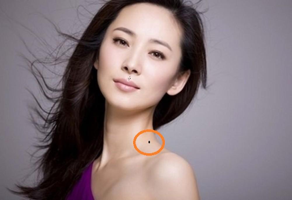 4 vị trí nốt ruồi được cho là tán lộc ở phụ nữ, cần phải xem xét việc tẩy xóa để không mang xui xẻo về-2