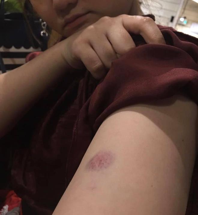 Khách Thái Lan bị tranh chỗ, gây sự ở Đà Lạt-2