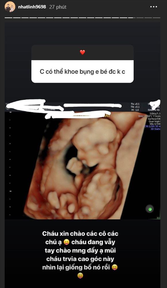 Sau 3 tuần làm đám cưới, vợ Phan Văn Đức khoe ảnh siêu âm cực nét về em bé trong bụng-2