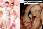 Sau 3 tuần làm đám cưới, vợ Phan Văn Đức khoe ảnh siêu âm cực nét về em bé trong bụng