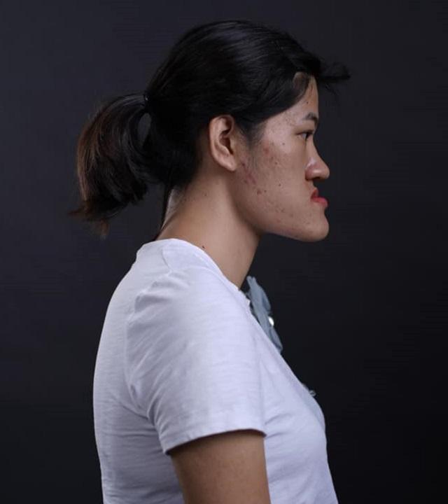 Cô gái Hà Nội tự nhận có gương mặt quỷ biến hóa thành hotgirl xinh ngỡ ngàng-1