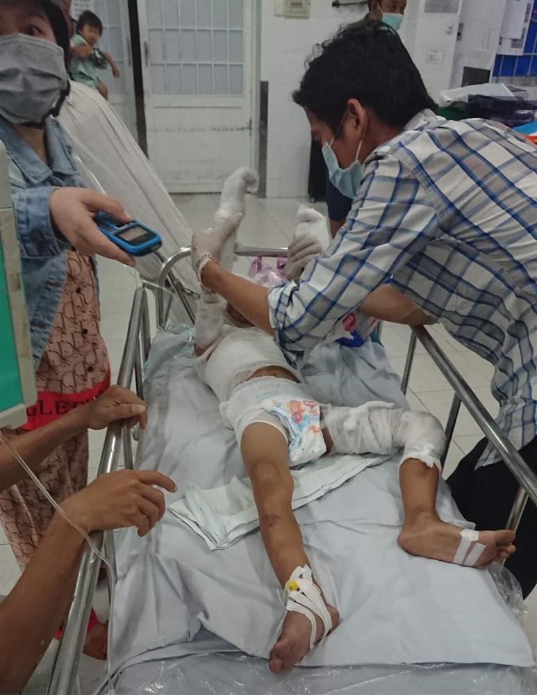 Vụ dì thiêu sống cháu ruột vì món nợ 3 triệu: Cả người mẹ cũng bị bỏng-3