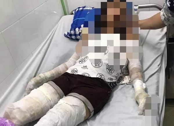 Vụ dì thiêu sống cháu ruột vì món nợ 3 triệu: Cả người mẹ cũng bị bỏng-2