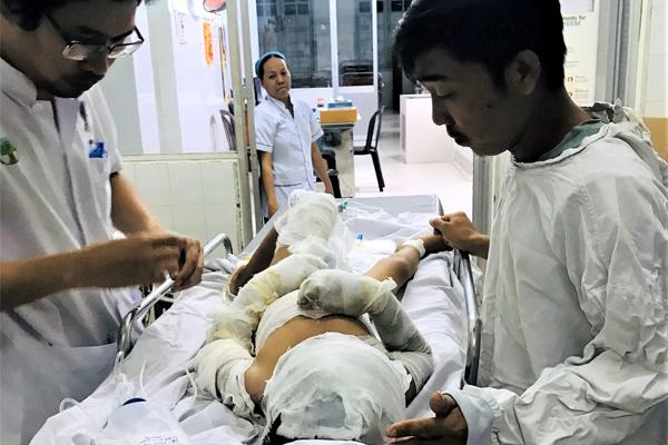 Cha bé trai bị dì tưới xăng: Sao nó ác thế-2