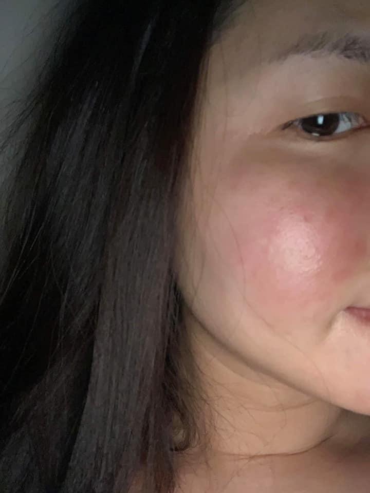 Vợ Đăng Khôi tủi thân khi bị nghi thẩm mỹ hỏng, tiết lộ sự thật về gương mặt sưng phù-2