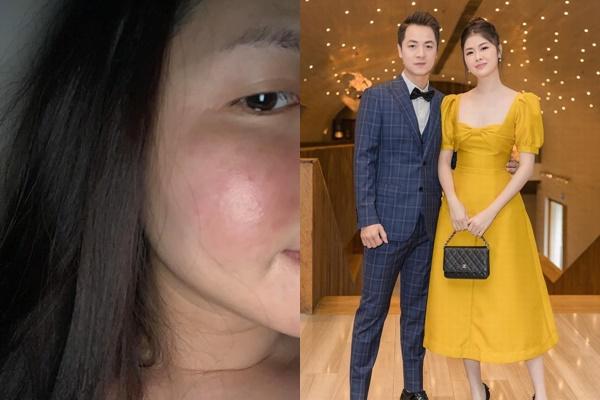 Đăng Khôi phẫu thuật viêm tai cấp, tâm sự của bà xã gây xúc động-5