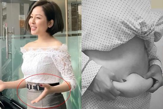 Bị chê 'phì nhiêu' dù tốn đống tiền thẩm mỹ, Trâm Anh dọa 'lấy mỡ đè chết' kẻ soi mói