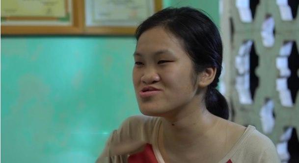 9X Phú Thọ như được hồi sinh sau 3 ca đại phẫu gương mặt-1