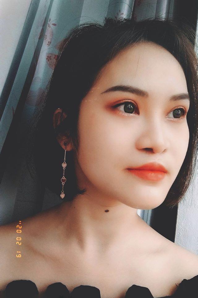 9X Phú Thọ như được hồi sinh sau 3 ca đại phẫu gương mặt-2