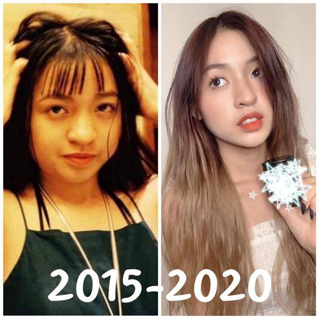 Crush của mọi chàng trai gây bất ngờ khi công khai ảnh quá khứ nặng 65kg, chưa niềng răng xong-1