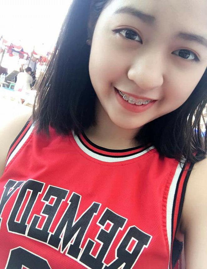 Crush của mọi chàng trai gây bất ngờ khi công khai ảnh quá khứ nặng 65kg, chưa niềng răng xong-2