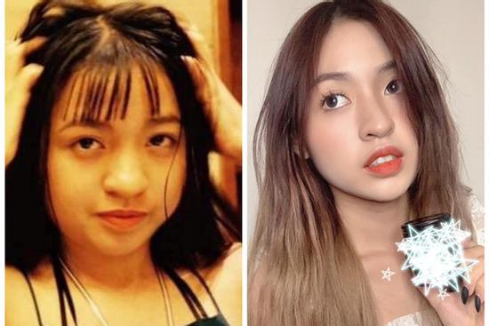 'Crush của mọi chàng trai' gây bất ngờ khi công khai ảnh quá khứ nặng 65kg, chưa niềng răng xong