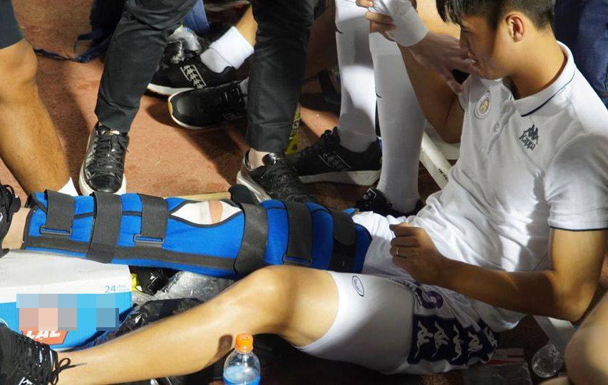 Duy Mạnh đứt dây chằng chéo, nghỉ 6-8 tháng-1