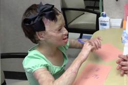 Hạnh phúc khi được cầm bút của bé gái Syria sau 3 năm bị trúng bom