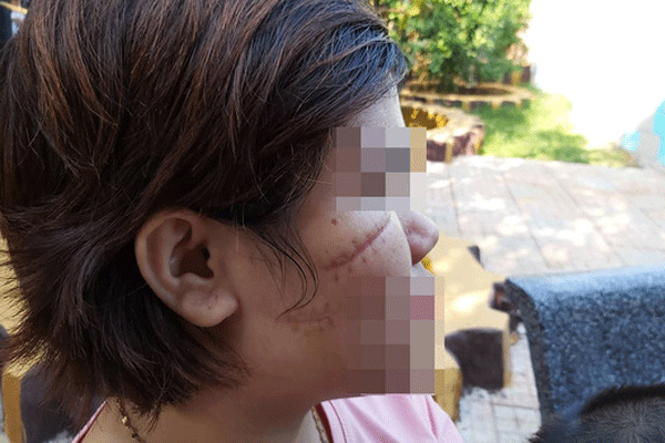 Nữ công nhân bị nhóm côn đồ chặn xe rạch mặt trước cổng công ty-1