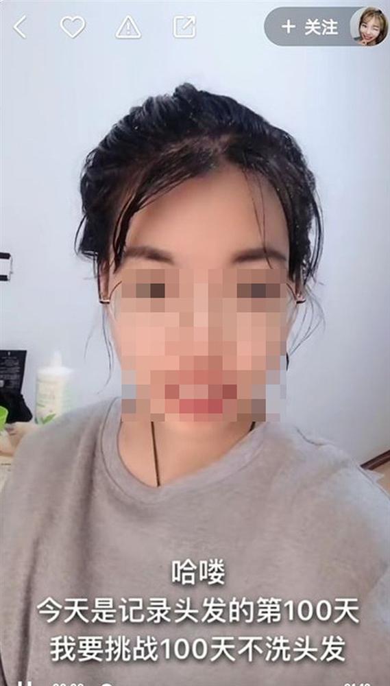 Cô gái tham gia thử thách 100 ngày không gội đầu, ảnh chậu nước sau khi gội thực sự ám ảnh người xem-2