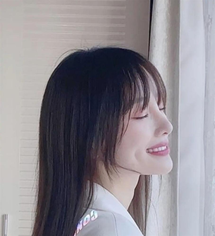 Cằm nhọn hoắt như sắp rơi khỏi mặt, Lý Tiểu Lộ bị nghi dao kéo không biết điểm dừng-2