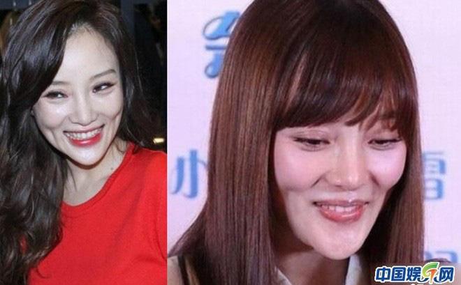 Cằm nhọn hoắt như sắp rơi khỏi mặt, Lý Tiểu Lộ bị nghi dao kéo không biết điểm dừng-3