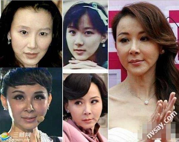 Từng là đệ nhất mĩ nhân Đài Loan lấn lướt cả Lâm Chí Linh, Tiêu Tường giờ thành thảm hoạ dao kéo, vướng tình cô - cháu vụng trộm-11