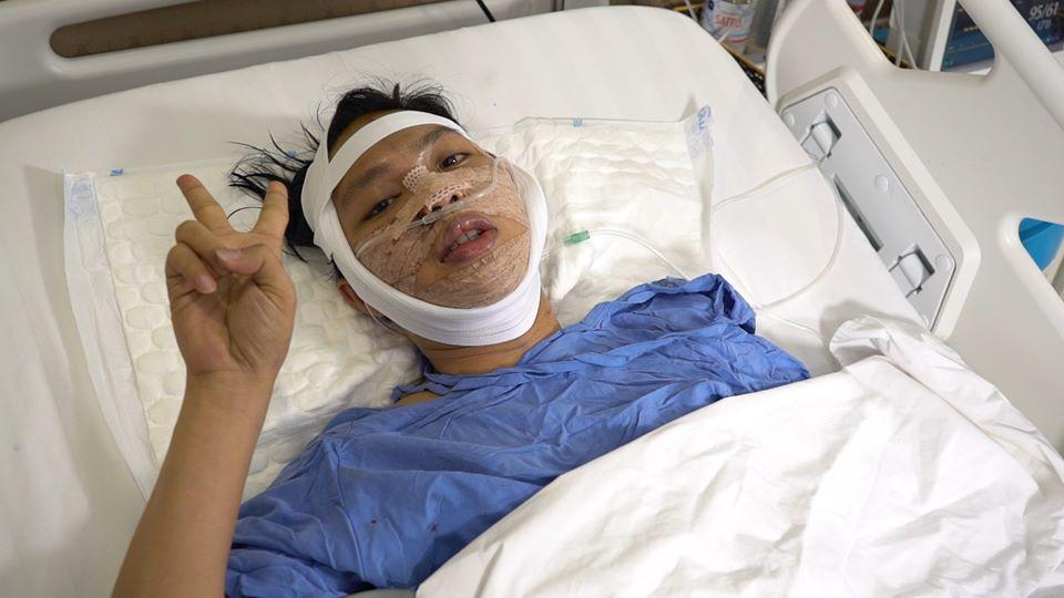 Phiên bản lỗi của Đức Phúc gây bất ngờ với diện mạo điển trai sau khi phẫu thuật thẩm mỹ-3