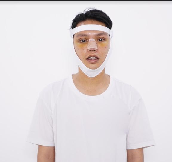 Phiên bản lỗi của Đức Phúc gây bất ngờ với diện mạo điển trai sau khi phẫu thuật thẩm mỹ-4