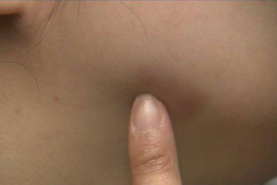 Cô gái Hàn Quốc bị đấm trật khớp hàm vì không đeo khẩu trang ở Mỹ