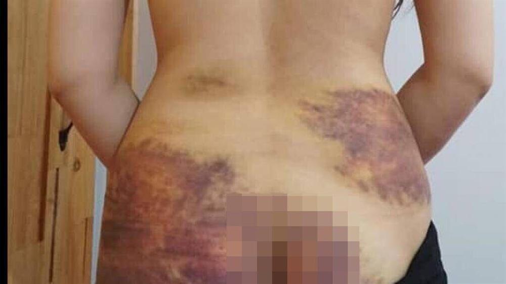 Diễn biến mới vụ cô gái 27 tuổi bị chồng bạo hành, ép quan hệ ở Tây Ninh-1
