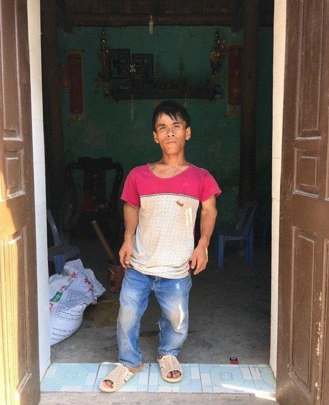 Gia đình 3 người lùn ở Hưng Yên: Ngày chỉ ăn một bữa, toàn uống nước lã và cháo loãng-2