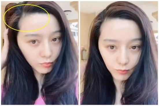 Vừa bị chê ở bẩn vì 7 ngày không gội đầu, Phạm Băng Băng còn bị antifan chê bai thêm phần trán