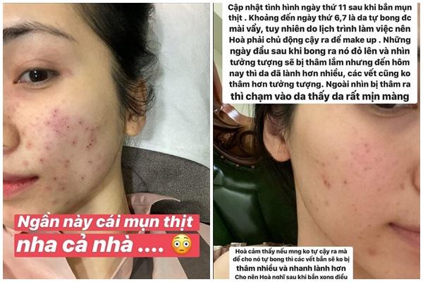 Hòa Minzy đã khéo léo giấu hói từ cấp 1 thế nào?-12