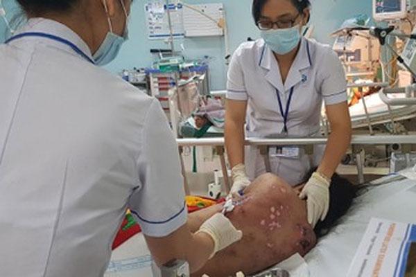 Nữ tiếp viên tố bị chủ quán cà phê ở Đồng Nai chích điện, đánh gãy xương sườn, nứt sọ...-1