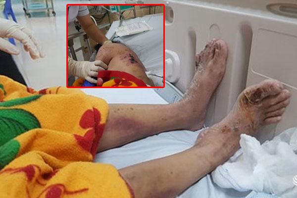 Chủ quán tra tấn nữ nhân viên vì không kích dục chiều khách-3