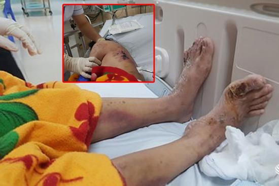 Nữ tiếp viên tố bị chủ quán cà phê ở Đồng Nai chích điện, đánh gãy xương sườn, nứt sọ...