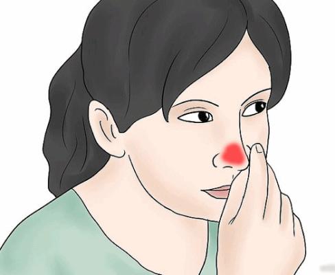 Tự nhiên xuất hiện những dấu hiệu này trên mặt, bảo sao tiền cứ không cánh mà bay-3