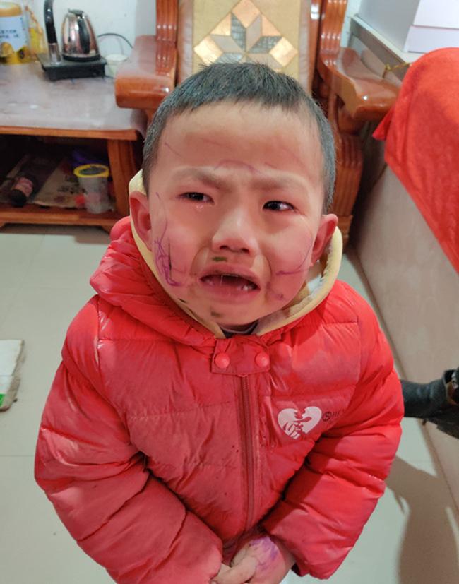 Nghịch ngợm dùng bút vẽ lên mặt, cậu bé khóc thét khi soi gương nhìn thành quả-2