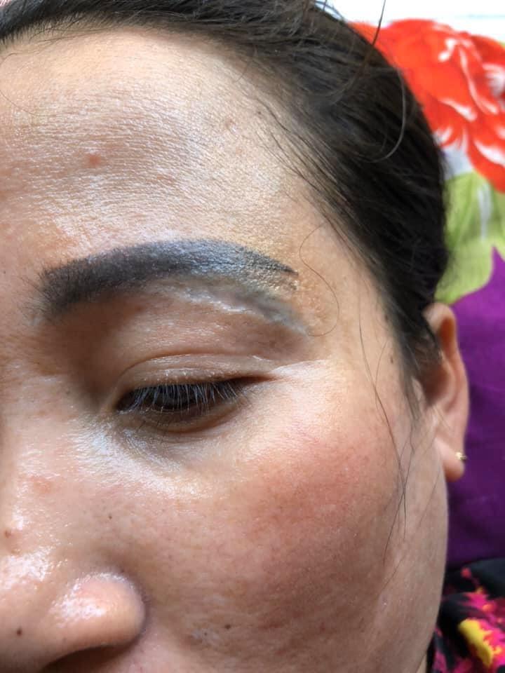 THẢM HỌA LÀM ĐẸP: Ham rẻ, bà thím có đến 3 hàng lông mày-1